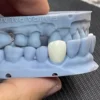 Geçici Diş Reçinesi - 3d geçici diş reçinesi - Görsel 2