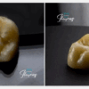 Daimi kalıcı Diş Reçinesi-3d yazıcı kalıcı kron - Görsel 3
