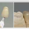 Daimi kalıcı Diş Reçinesi-3d yazıcı kalıcı kron - Görsel 4